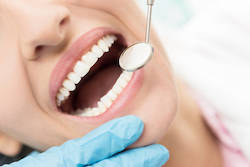 dentist using mouth mirror to examine teeth
