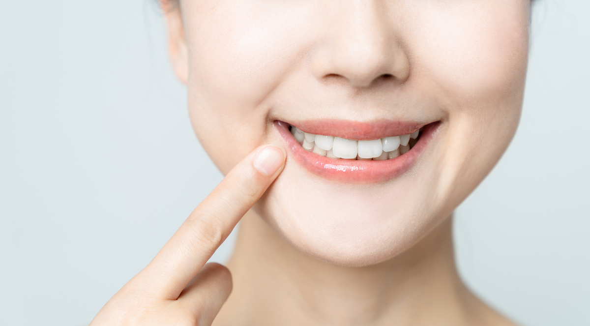 woman pointing to her healthy smile